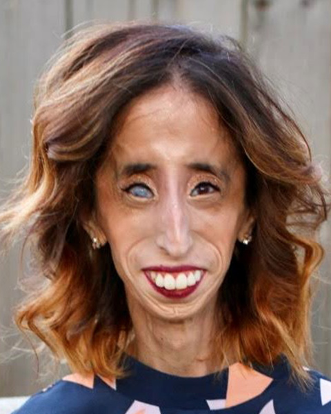 Lizzie Velasquez photo